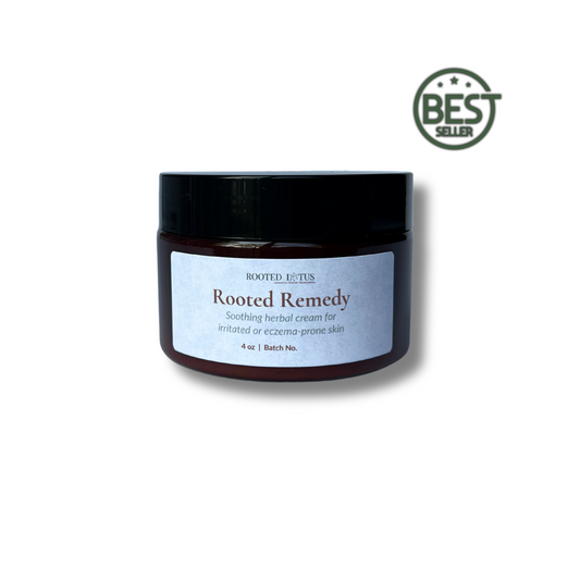 Rooted Remedy - Eczema Cream